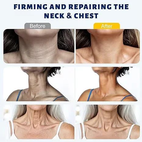 GLOVYNS™ 5-Roller Neck Firming Cream – Collagen & Hyaluronic Acid for Smoother, Tighter-Looking Neck Skin