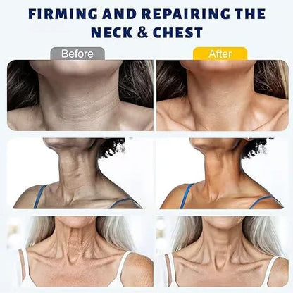 GLOVYNS™ 5-Roller Neck Firming Cream – Collagen & Hyaluronic Acid for Smoother, Tighter-Looking Neck Skin