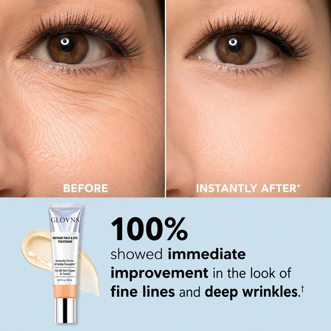 GLOVYNS™ Instant Face Temporary Tightener – Instant visible results in 60 seconds
