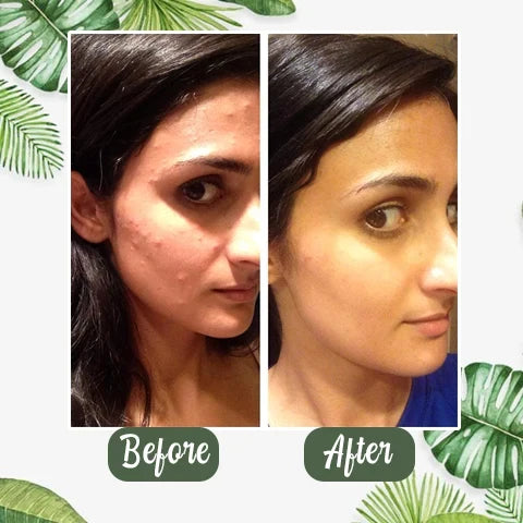 GLOVYNS™ 100% Natural Green Tea Deep Cleanse Mask