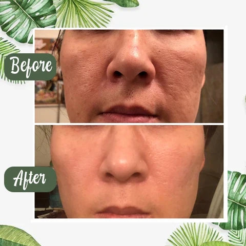 GLOVYNS™ 100% Natural Green Tea Deep Cleanse Mask