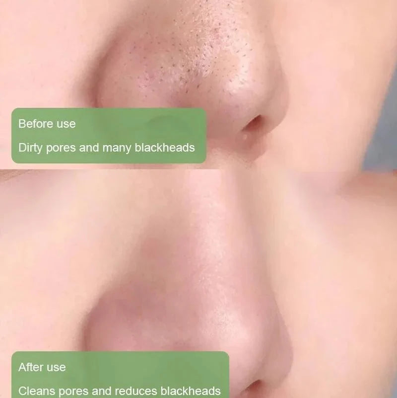 GLOVYNS™ 100% Natural Green Tea Deep Cleanse Mask