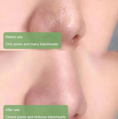 GLOVYNS™ 100% Natural Green Tea Deep Cleanse Mask
