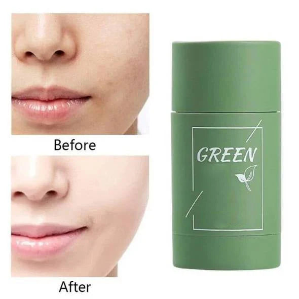 GLOVYNS™ 100% Natural Green Tea Deep Cleanse Mask